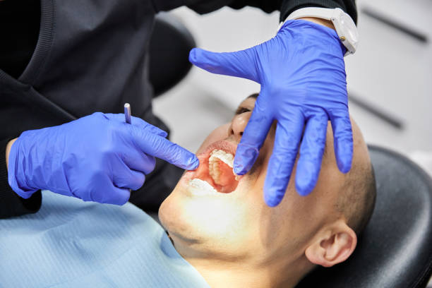Best Emergency Cosmetic Dentistry (e.g., broken veneers) in Memphis, TN